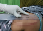 Cekcok Mulut Berujung Kekerasan, Oknum PNS di Lape Aniaya Dua IRT dengan Parang